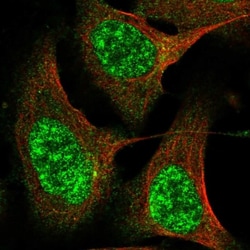 CWF19L2 Antibody, Novus Biologicals 25 &mu;L; Unlabeled:Antibodies, Polyclonal
